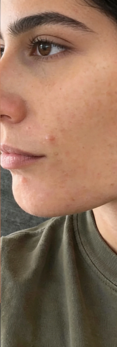 Before and after transformation