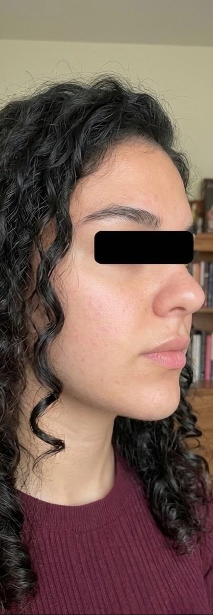 Before and after transformation